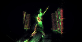 SCHNELLE BUNTE BILDER